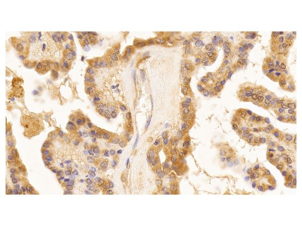aladdin 阿拉丁 Ab112658 Lamin B1 Mouse mAb mAb (C2); Mouse anti Human Lamin B1 Antibody; WB, IHC; Unconjugated