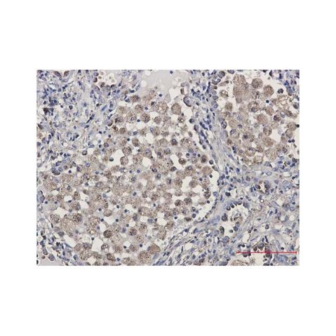aladdin 阿拉丁 Ab112746 Recombinant LAMP2 Antibody Recombinant (R03-0B5); Rabbit anti Human LAMP2 Antibody; WB, IHC; Unconjugated