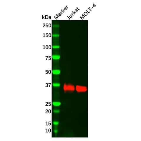 aladdin 阿拉丁 Ab112829 Recombinant LAT Antibody Recombinant (R03-2G2); Rabbit anti Human LAT Antibody; WB, IHC; Unconjugated