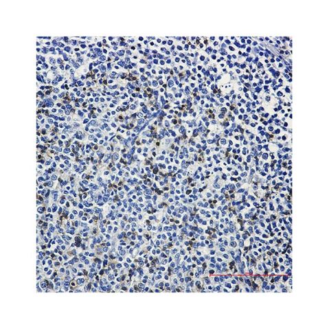 aladdin 阿拉丁 Ab112829 Recombinant LAT Antibody Recombinant (R03-2G2); Rabbit anti Human LAT Antibody; WB, IHC; Unconjugated
