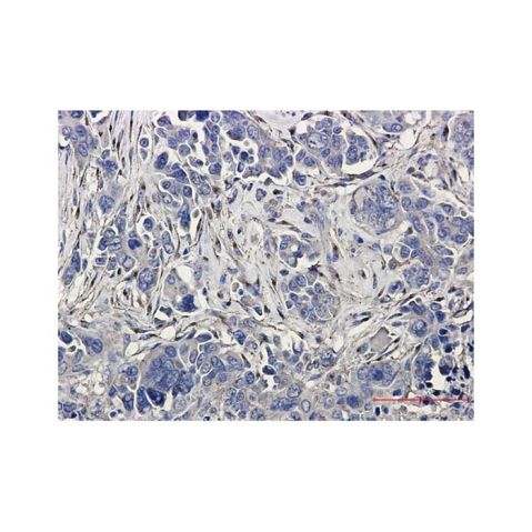 aladdin 阿拉丁 Ab113511 Recombinant LRP1 Antibody Recombinant (R09-4E8); Rabbit anti Human LRP1 Antibody; WB, IHC, ICC, IF; Unconjugated