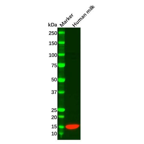 aladdin 阿拉丁 Ab113835 Recombinant Lysozyme Antibody Recombinant (R09-9D6); Rabbit anti Human Lysozyme Antibody; WB, ICC, IF; Unconjugated