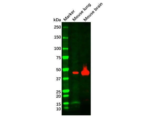 aladdin 阿拉丁 Ab114868 Recombinant MEK2 Antibody Recombinant (R05-2G7); Rabbit anti Human MEK2 Antibody; WB, IHC, ICC, IF; Unconjugated