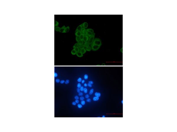 aladdin 阿拉丁 Ab114868 Recombinant MEK2 Antibody Recombinant (R05-2G7); Rabbit anti Human MEK2 Antibody; WB, IHC, ICC, IF; Unconjugated