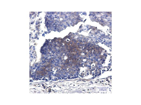 aladdin 阿拉丁 Ab114868 Recombinant MEK2 Antibody Recombinant (R05-2G7); Rabbit anti Human MEK2 Antibody; WB, IHC, ICC, IF; Unconjugated