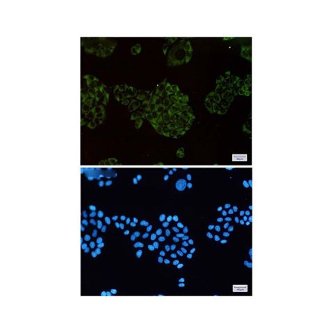 aladdin 阿拉丁 Ab114897 Recombinant MEKK2 Antibody Recombinant (R06-2K7); Rabbit anti Human MEKK2 Antibody; WB, IF, ICC; Unconjugated