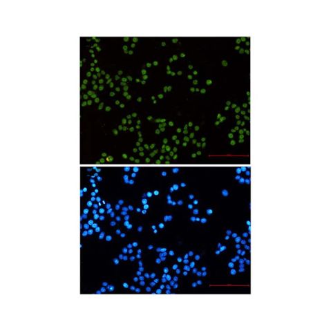 aladdin 阿拉丁 Ab115549 Recombinant MLH1 Antibody Recombinant (R07-5D3); Rabbit anti Human MLH1 Antibody; WB, ICC, IF; Unconjugated