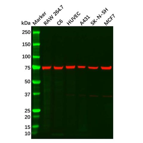 aladdin 阿拉丁 Ab115657 MMP2 Mouse mAb mAb (C1); Mouse anti Human MMP2 Antibody; WB, IHC; Unconjugated