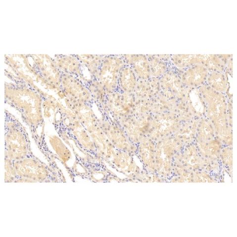 aladdin 阿拉丁 Ab115657 MMP2 Mouse mAb mAb (C1); Mouse anti Human MMP2 Antibody; WB, IHC; Unconjugated