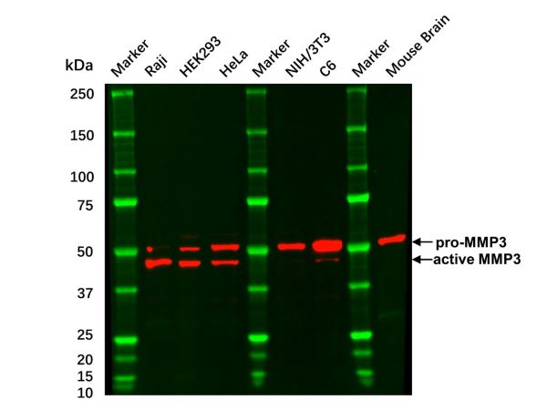 aladdin 阿拉丁 Ab115686 Recombinant MMP3 Antibody Recombinant (R04-8G6); Rabbit anti Human MMP3 Antibody; WB, IHC; Unconjugated