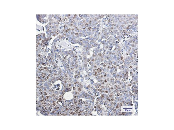 aladdin 阿拉丁 Ab115686 Recombinant MMP3 Antibody Recombinant (R04-8G6); Rabbit anti Human MMP3 Antibody; WB, IHC; Unconjugated