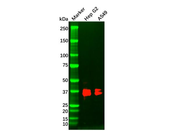 aladdin 阿拉丁 Ab116122 MSI2 Mouse mAb mAb(2C11); Mouse anti Human MSI2 Antibody; WB, IHC, ELISA; Unconjugated