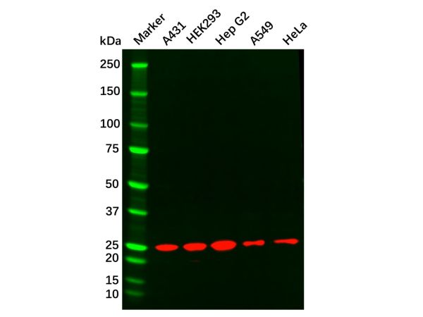 aladdin 阿拉丁 Ab116339 Recombinant mtTFA Antibody Recombinant (R08-3E2); Rabbit anti Human mtTFA Antibody; WB, IHC, IF, ICC; Unconjugated