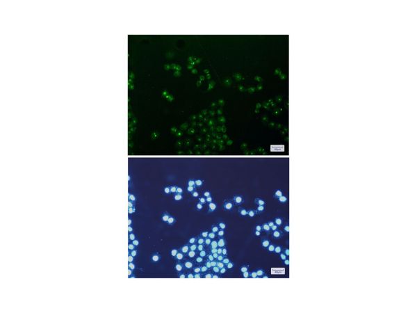 aladdin 阿拉丁 Ab116339 Recombinant mtTFA Antibody Recombinant (R08-3E2); Rabbit anti Human mtTFA Antibody; WB, IHC, IF, ICC; Unconjugated