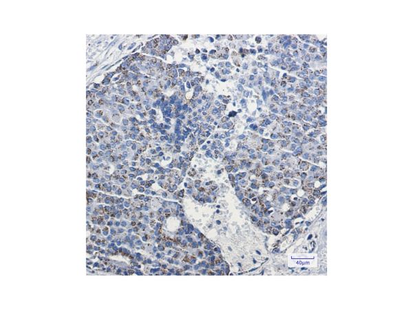 aladdin 阿拉丁 Ab116339 Recombinant mtTFA Antibody Recombinant (R08-3E2); Rabbit anti Human mtTFA Antibody; WB, IHC, IF, ICC; Unconjugated