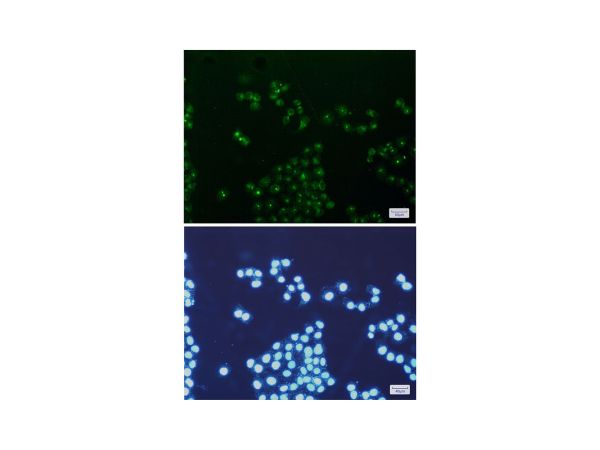 aladdin 阿拉丁 Ab116339 Recombinant mtTFA Antibody Recombinant (R08-3E2); Rabbit anti Human mtTFA Antibody; WB, IHC, IF, ICC; Unconjugated