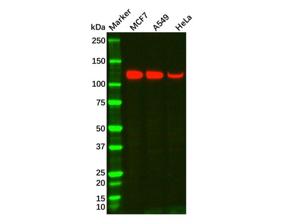 aladdin 阿拉丁 Ab116451 Recombinant MUC4 Antibody Recombinant (R02-7G1); Rabbit anti Human MUC4 Antibody; WB; Unconjugated