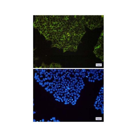 aladdin 阿拉丁 Ab117894 Recombinant NFkB p100/NFKB2 Antibody Recombinant (R04-4D6); Rabbit anti Human NFkB p100/NFKB2 Antibody; WB, IF, ICC; Unconjugated