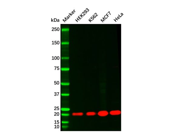 aladdin 阿拉丁 Ab118705 Recombinant NRAS Antibody Recombinant (R01-7D0); Rabbit anti Human NRAS Antibody; WB; Unconjugated