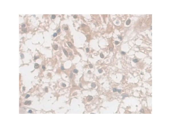 aladdin 阿拉丁 Ab118776 CD8 alpha Mouse mAb mAb (C14); Mouse anti Human CD8 alpha Antibody; WB, IHC; Unconjugated