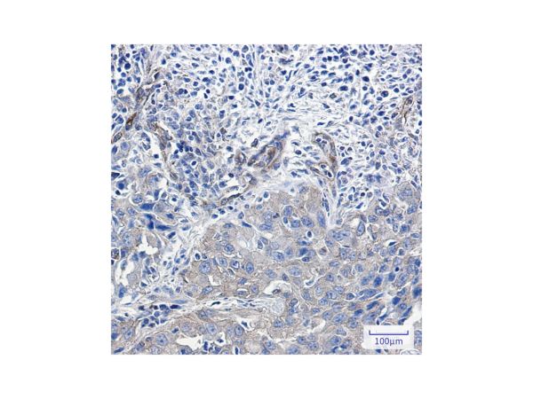aladdin 阿拉丁 Ab119000 Recombinant NUMB Antibody Recombinant (R09-2I5); Rabbit anti Human NUMB Antibody; WB, IHC; Unconjugated