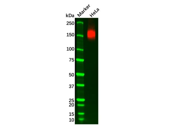 aladdin 阿拉丁 Ab119577 Recombinant P Glycoprotein Antibody Recombinant (R02-6B2); Rabbit anti Human P Glycoprotein Antibody; WB; Unconjugated