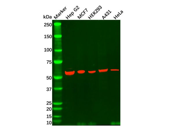 aladdin 阿拉丁 Ab119767 P4HB Antibody pAb; Rabbit anti Human P4HB Antibody; WB; Unconjugated