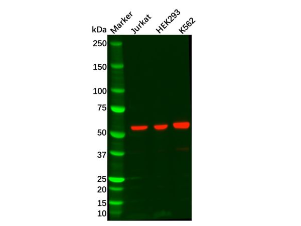 aladdin 阿拉丁 Ab119916 Recombinant P70 S6 Kinase beta/SRK Antibody Recombinant (R04-9C1); Rabbit anti Human P70 S6 Kinase beta/SRK Antibody; WB, IHC, ICC, IF; Unconjugated