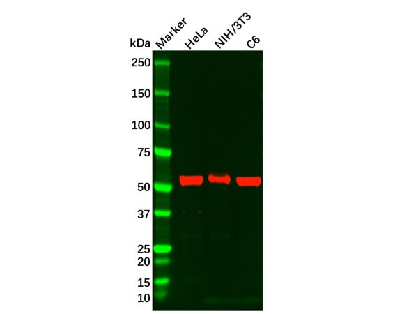 aladdin 阿拉丁 Ab119916 Recombinant P70 S6 Kinase beta/SRK Antibody Recombinant (R04-9C1); Rabbit anti Human P70 S6 Kinase beta/SRK Antibody; WB, IHC, ICC, IF; Unconjugated