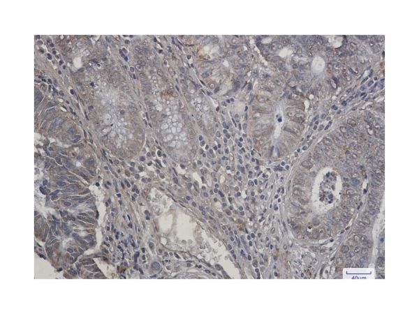 aladdin 阿拉丁 Ab119916 Recombinant P70 S6 Kinase beta/SRK Antibody Recombinant (R04-9C1); Rabbit anti Human P70 S6 Kinase beta/SRK Antibody; WB, IHC, ICC, IF; Unconjugated
