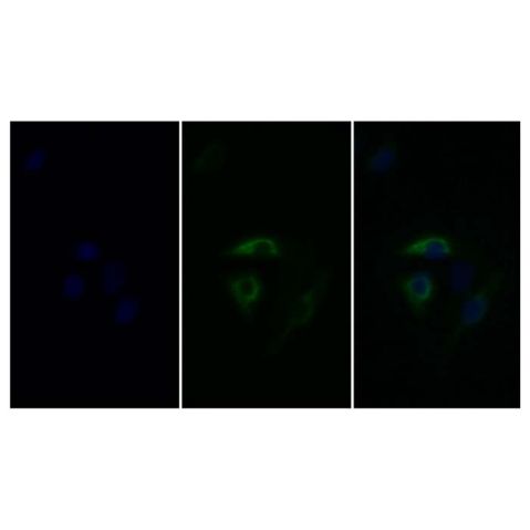 aladdin 阿拉丁 Ab120074 PAI1 Mouse mAb mAb(J11); Mouse anti Human PAI1 Antibody; WB, IHC, IF, ICC; Unconjugated