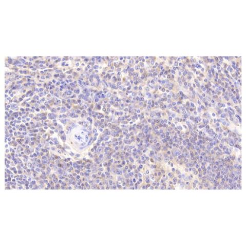 aladdin 阿拉丁 Ab120346 PARK7 Antibody pAb; Rabbit anti Human PARK7 Antibody; WB, IHC; Unconjugated