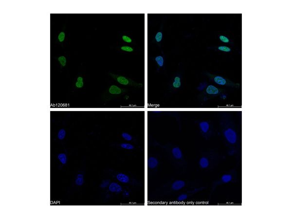 aladdin 阿拉丁 Ab120681 Recombinant PCNA Antibody Recombinant (RR704); Rabbit anti Human PCNA Antibody; WB, Flow, IP; Unconjugated