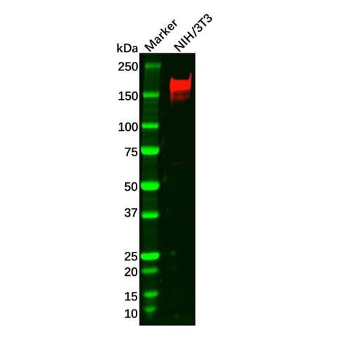 aladdin 阿拉丁 Ab120939 Recombinant PDGFR beta Antibody Recombinant (R02-5B2); Rabbit anti Human PDGFR beta Antibody; WB; Unconjugated