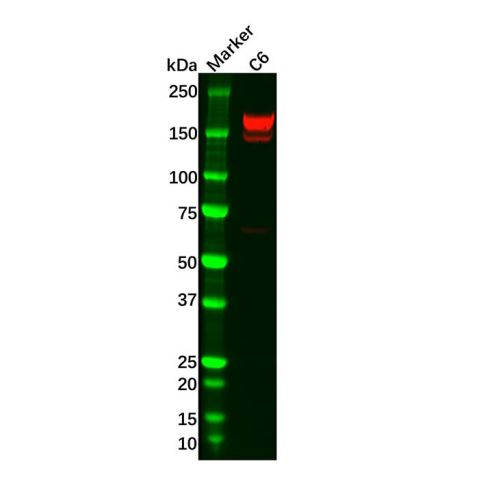 aladdin 阿拉丁 Ab120939 Recombinant PDGFR beta Antibody Recombinant (R02-5B2); Rabbit anti Human PDGFR beta Antibody; WB; Unconjugated
