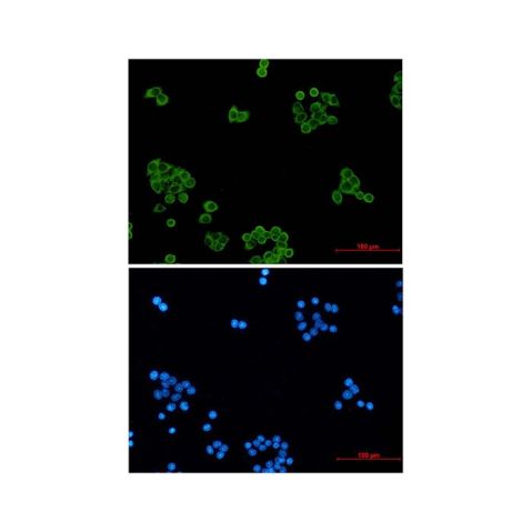 aladdin 阿拉丁 Ab121313 Recombinant Peroxiredoxin 1/PAG Antibody Recombinant (R04-0H5); Rabbit anti Human Peroxiredoxin 1/PAG Antibody; WB, ICC, IF; Unconjugated
