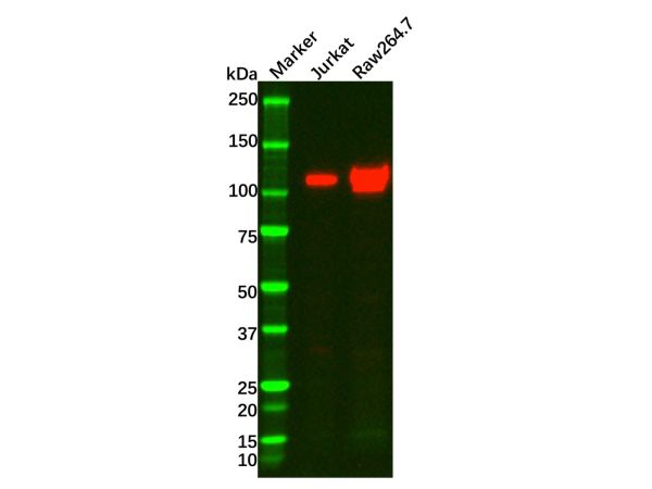 aladdin 阿拉丁 Ab121760 Recombinant PI 3 Kinase p110 delta Antibody Recombinant (R06-7A9); Rabbit anti Human PI 3 Kinase p110 delta Antibody; WB; Unconjugated