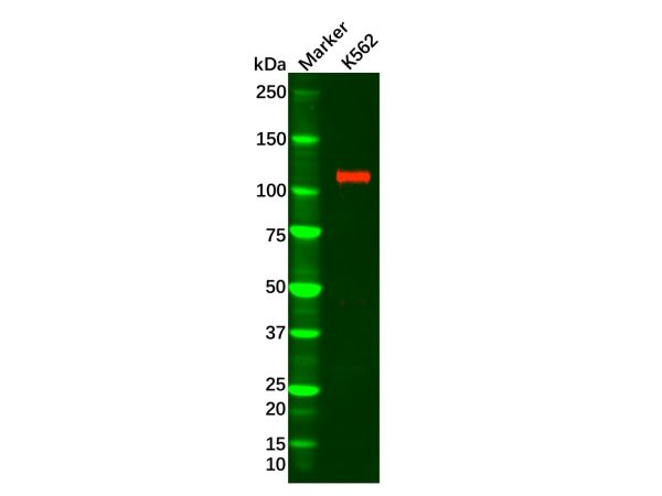 aladdin 阿拉丁 Ab121760 Recombinant PI 3 Kinase p110 delta Antibody Recombinant (R06-7A9); Rabbit anti Human PI 3 Kinase p110 delta Antibody; WB; Unconjugated