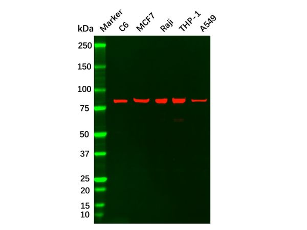 aladdin 阿拉丁 Ab121772 Recombinant PI 3 Kinase p85 alpha ?Antibody Recombinant (R03-3C7); Rabbit anti Human PIK3R1 Antibody; WB, ICC, IF; Unconjugated
