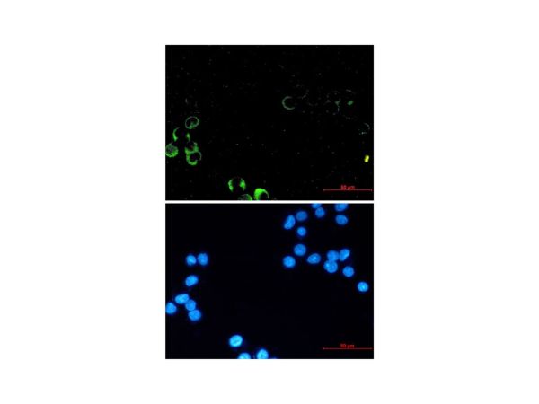 aladdin 阿拉丁 Ab121772 Recombinant PI 3 Kinase p85 alpha ?Antibody Recombinant (R03-3C7); Rabbit anti Human PIK3R1 Antibody; WB, ICC, IF; Unconjugated