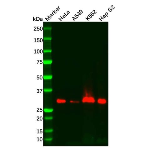 aladdin 阿拉丁 Ab121877 Recombinant PIM1 Antibody Recombinant (R08-8D5); Rabbit anti Human PIM1 Antibody; WB, IHC; Unconjugated