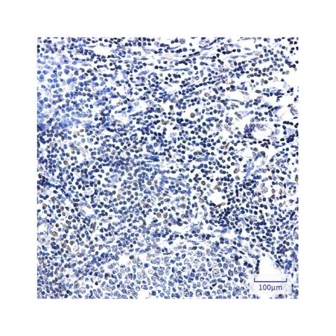 aladdin 阿拉丁 Ab121877 Recombinant PIM1 Antibody Recombinant (R08-8D5); Rabbit anti Human PIM1 Antibody; WB, IHC; Unconjugated