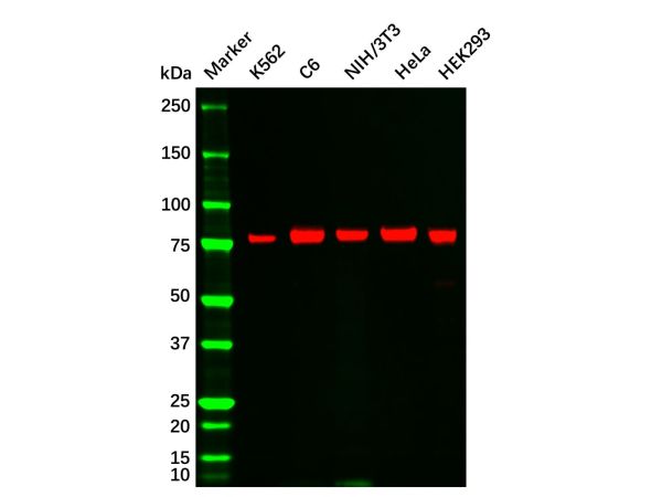 aladdin 阿拉丁 Ab122024 Recombinant PKC alpha Antibody Recombinant (R05-4E5); Rabbit anti Human PKC alpha Antibody; WB, IHC; Unconjugated