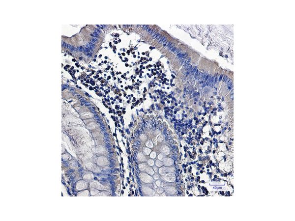 aladdin 阿拉丁 Ab122024 Recombinant PKC alpha Antibody Recombinant (R05-4E5); Rabbit anti Human PKC alpha Antibody; WB, IHC; Unconjugated
