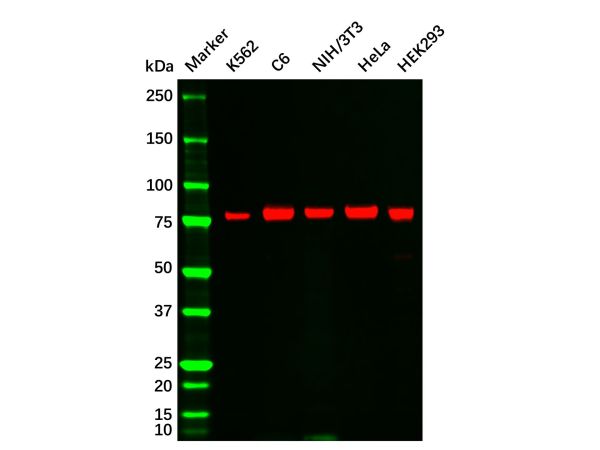 aladdin 阿拉丁 Ab122024 Recombinant PKC alpha Antibody Recombinant (R05-4E5); Rabbit anti Human PKC alpha Antibody; WB, IHC; Unconjugated