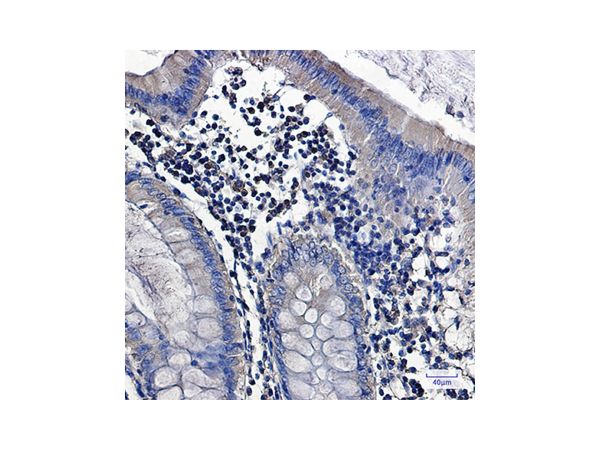 aladdin 阿拉丁 Ab122024 Recombinant PKC alpha Antibody Recombinant (R05-4E5); Rabbit anti Human PKC alpha Antibody; WB, IHC; Unconjugated
