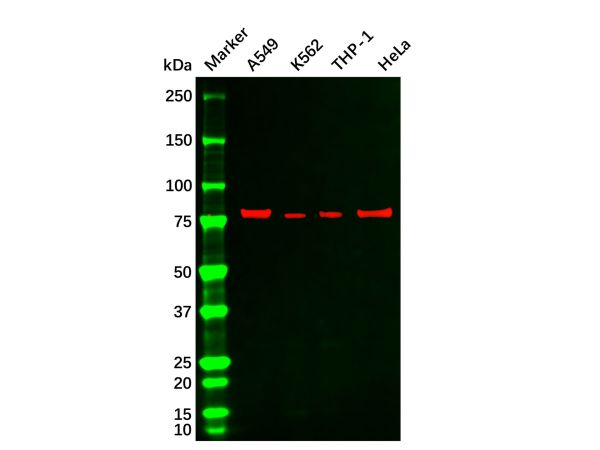 aladdin 阿拉丁 Ab122050 Recombinant PKC beta 2 Antibody Recombinant (R06-0C2); Rabbit anti Human PKC beta 2 Antibody; WB, IHC, ICC, IF; Unconjugated