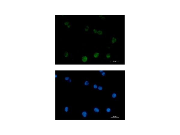 aladdin 阿拉丁 Ab122050 Recombinant PKC beta 2 Antibody Recombinant (R06-0C2); Rabbit anti Human PKC beta 2 Antibody; WB, IHC, ICC, IF; Unconjugated