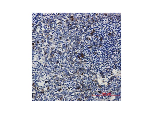 aladdin 阿拉丁 Ab122050 Recombinant PKC beta 2 Antibody Recombinant (R06-0C2); Rabbit anti Human PKC beta 2 Antibody; WB, IHC, ICC, IF; Unconjugated