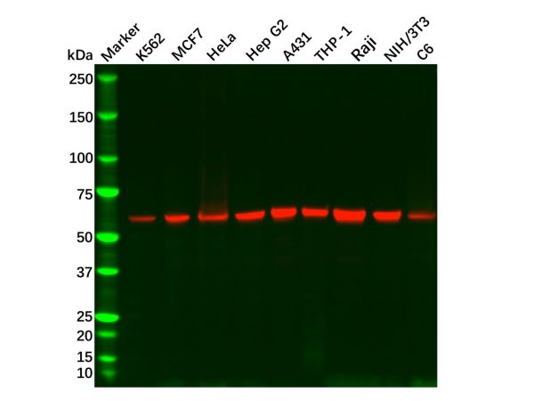 aladdin 阿拉丁 Ab122143 PKM Antibody pAb; Rabbit anti Human PKM Antibody; WB, IHC, ICC, IF; Unconjugated